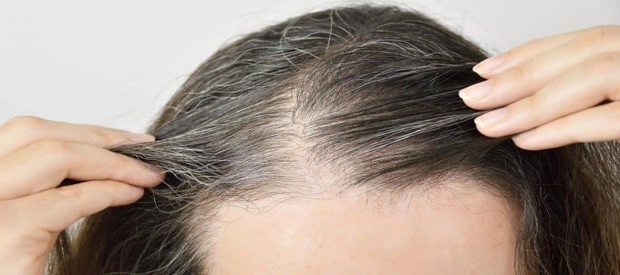hairtransplantation for women