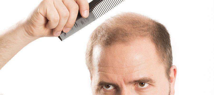 dhi-hair-transplant