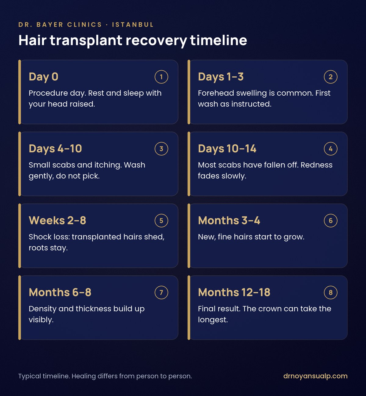 Hair transplant recovery timeline from the day of the procedure to months 12 to 18